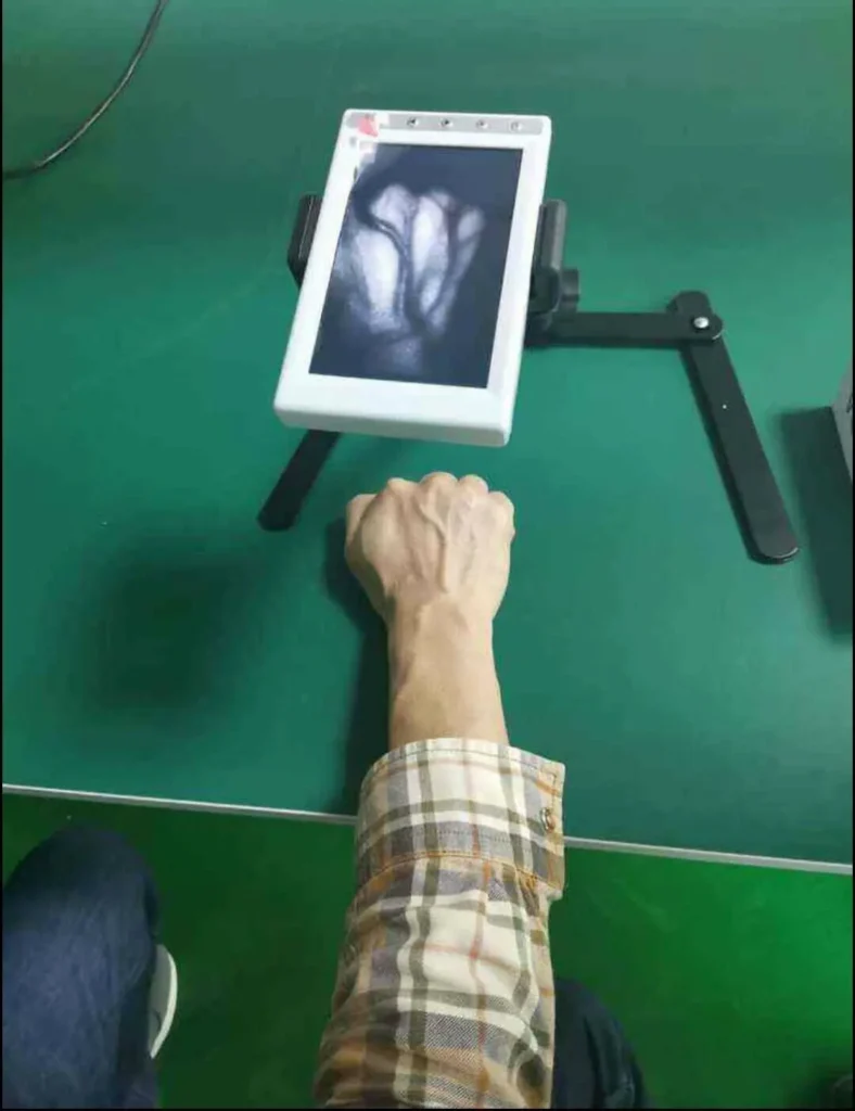 Vēnu Diagnostikas ierīces